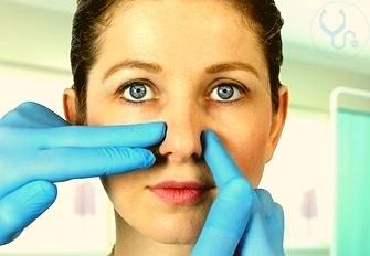 List of tests before rhinoplasty